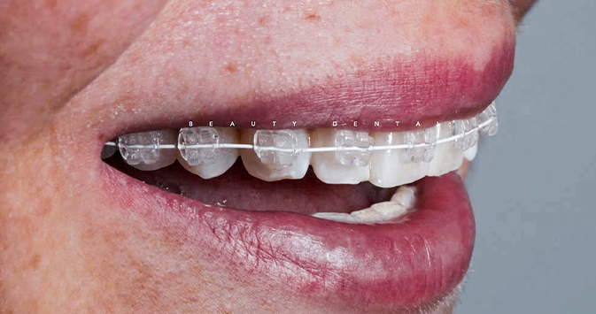 Clínica Beauty Dental